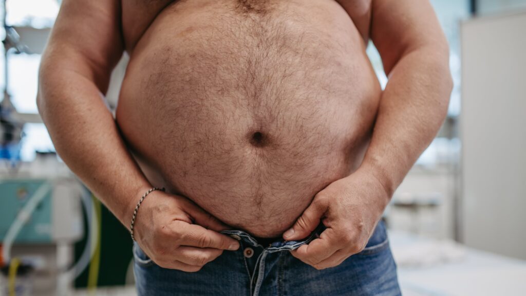 close-up-of-abdomen-of-overweight-patient